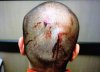 George-Zimmermans-head-injuries.jpg