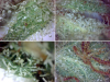 Trichomes under the Microscope - Good & Evil (2017-Oct-11) [640x480] .PNG