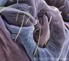 Z4450336-Spider_mite_s_skin_surface,_SEM-SPL.jpg