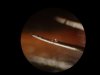 Spider leg spine tip 2.jpg Spider leg spine tip 2.jpg