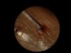 Spider leg spine.jpg Spider leg spine.jpg