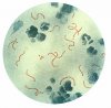 611px-Streptococcus_pyogenes_01.jpg