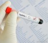 blood-test-tube-with-syphilis-indicated[1].jpg