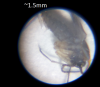 Pest.png