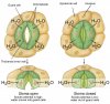 FIg-9-16-Open-Close-Stoma.jpg