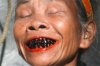 betel-nut-black-teeth.jpg