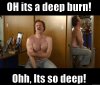 Oh-Its-A-Deep-Burn-Funny-Meme-Picture-1.jpg