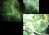 trichome.png