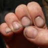 NailHash
