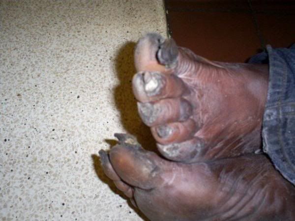 Nastyfeet.jpg