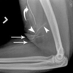 t1main.xray.rsna.jpg