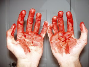 Bloody_hands.jpg