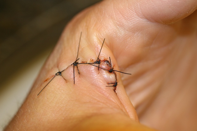 2008_sutures-2_scott-livingston_2008-04-09.jpg