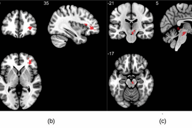 neurosciencenews.com