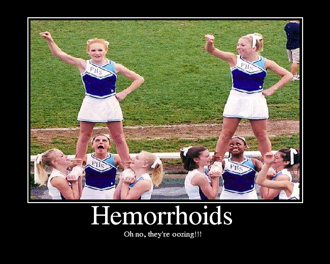 Hemorrhoids - Picture