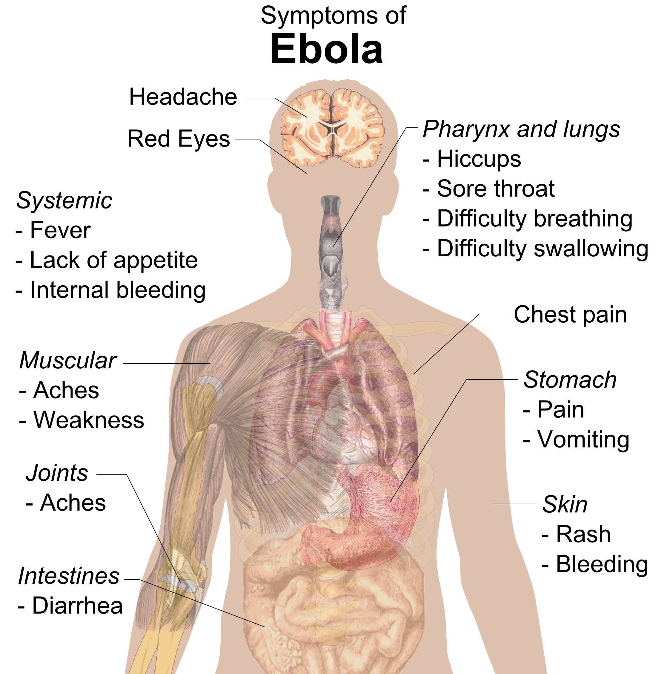Symptoms_of_ebola.png