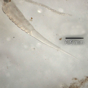 Evermicularis_SC_posterior.jpg