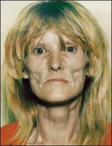meth%20addict.jpg